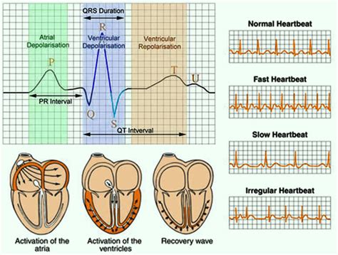 ecg result validity period philippines|ECG Test in the Philippines .